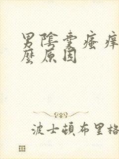 男阴囊瘙痒是什么原因