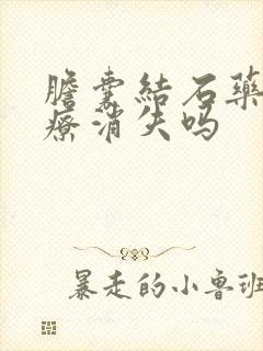 胆囊结石药物治疗消失吗