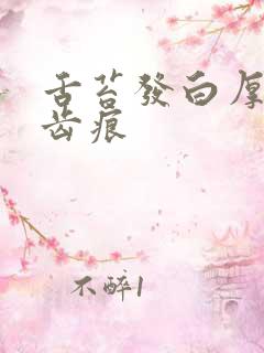 舌苔发白厚腻有齿痕