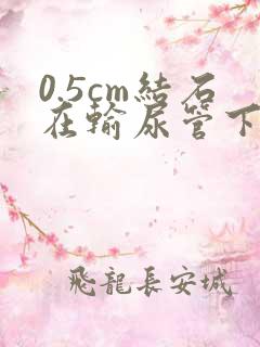 0.5cm结石在输尿管下段卡住怎么办