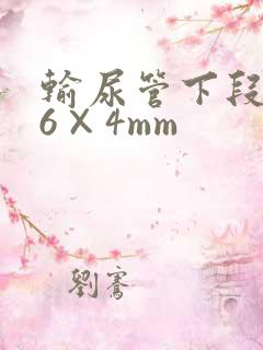 输尿管下段结石6×4mm