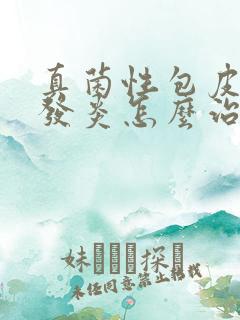 真菌性包皮龟头发炎怎么治疗