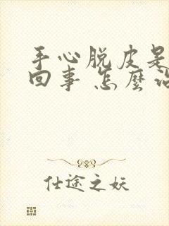 手心脱皮是怎么回事 怎么治疗