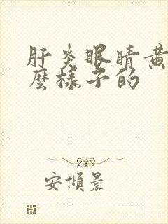 肝炎眼睛黄是什么样子的