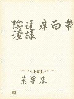 阴道痒白带豆腐渣样