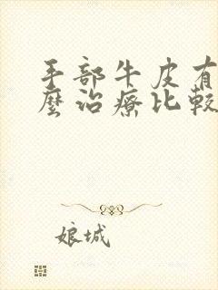 手部牛皮有癣怎么治疗比较好