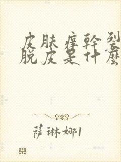 皮肤痒干裂变硬脱皮是什么病