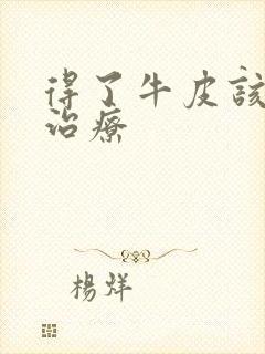 得了牛皮该怎么治疗