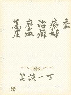 怎么治疗季节牛皮血癣好