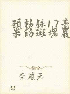 颈动脉1.7毫米的斑块严重吗