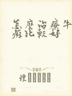 怎么治疗牛皮有癣比较好