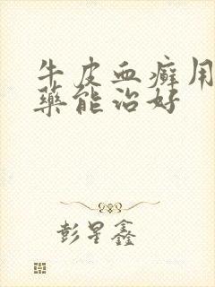 牛皮血癣用什么药能治好