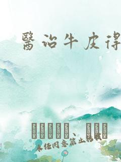 医治牛皮得方法