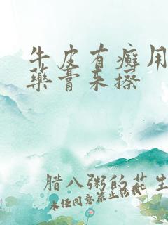 牛皮有癣用什么药膏来擦