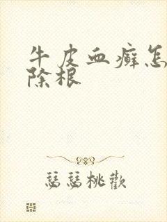 牛皮血癣怎么能除根