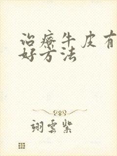 治疗牛皮有什么好方法