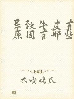 导致牛皮有癣的原因有哪些