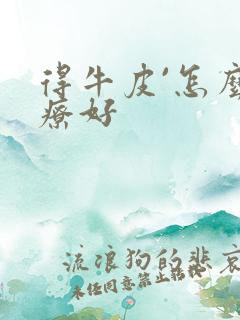 得牛皮`怎么治疗好