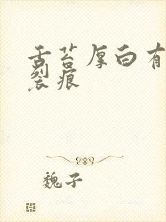 舌苔厚白有齿痕裂痕