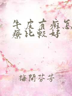 牛皮有癣怎么治疗比较好