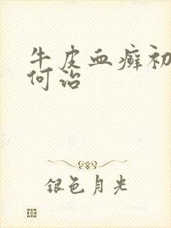 牛皮血癣初期如何治