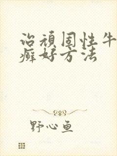 治顽固性牛皮有癣好方法