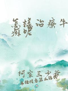 怎样治疗牛皮有癣呢