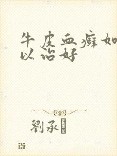 牛皮血癣如何可以治好