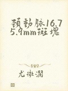 颈动脉16.75.9mm斑块
