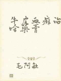 牛皮血癣治疗用啥药膏