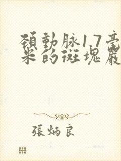 颈动脉1.7毫米的斑块严重吗