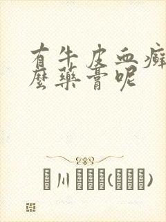 有牛皮血癣用什么药膏呢