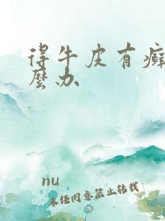 得牛皮有癣了怎么办