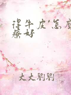 得牛皮`怎么治疗好