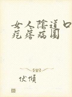 女人阴道口长小疙瘩病图