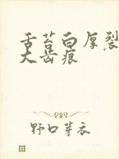 舌苔白厚裂纹肥大齿痕