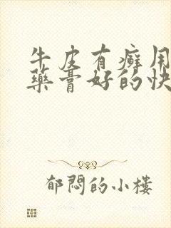 牛皮有癣用什么药膏好的快