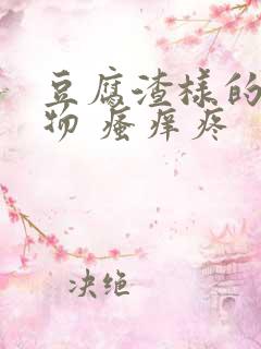 豆腐渣样的分泌物 瘙痒疼