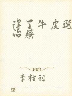 得了牛皮选怎么治疗