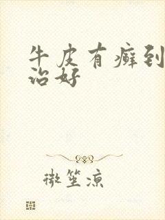 牛皮有癣到哪里治好