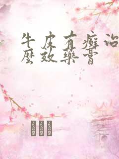 牛皮有癣治疗什么效药膏