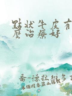 点状牛皮有癣怎么治疗好