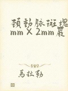 颈动脉斑块16mm×2mm严重吗