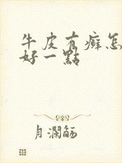 牛皮有癣怎么治好一点