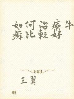 如何治疗牛皮有癣比较好