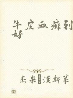 牛皮血癣到哪治好