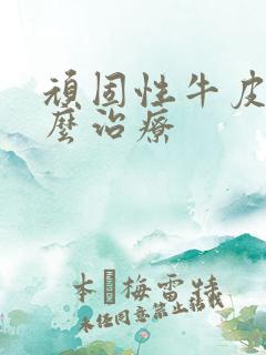 顽固性牛皮选怎么治疗