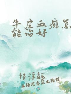 牛皮血癣怎么才能治好