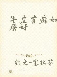 牛皮有癣如何治疗好