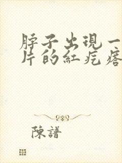 脖子出现一片一片的红疙瘩